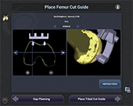 Navio Surgical System 2