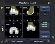 Navio Surgical System 6