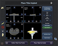 Navio Surgical System 7