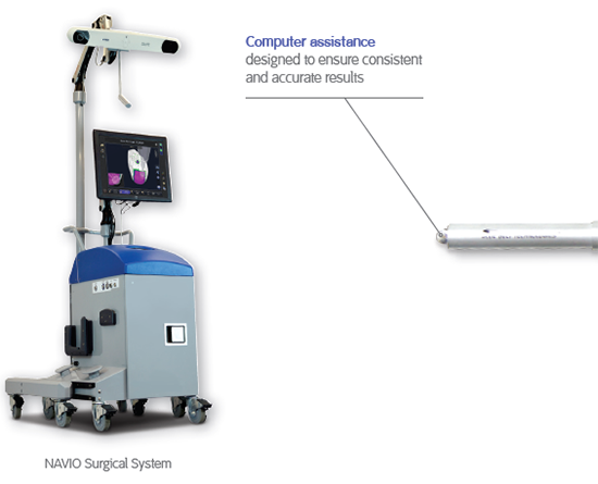 Navio Surgical System